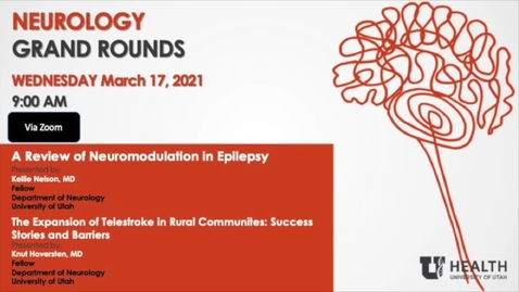 Thumbnail for "A Review of Neuromodulation in Epilepsy" &amp; " The Expansion of Telestroke in Rural Communities: Success Stories and Barriers"