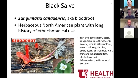 Thumbnail for 2/5/2021 Hyperhidrosis