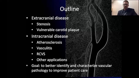 Thumbnail for Vessel Wall Imaging