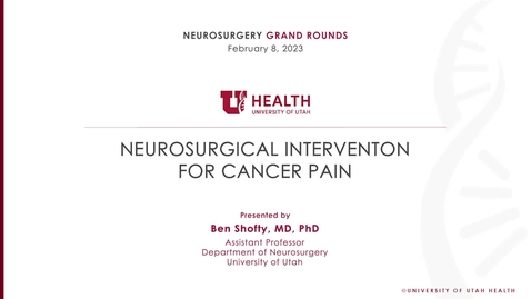 Thumbnail for Neurosurgical Interventon for Cancer Pain