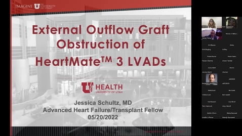 Thumbnail for External outflow graft obstruction of HeartMate 3 LVADs