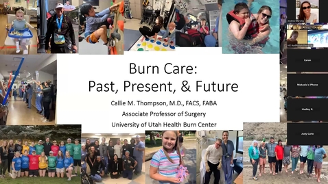Thumbnail for 11/6/2024 - &quot;Burn Care: Past, Present, and Future&quot;