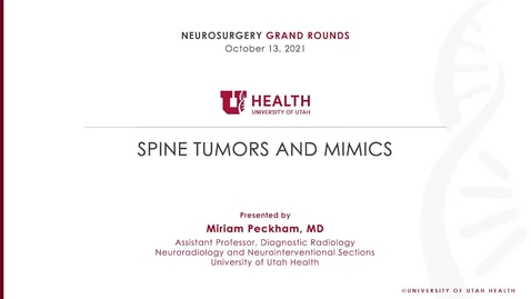 Thumbnail for Spine Tumors and Mimics