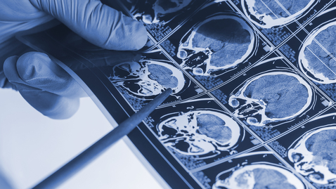 Thumbnail for Seven Questions for a Functional Neurosurgeon