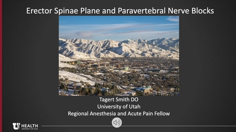 Thumbnail for Erector Spinae Plane Block and Paravertebral Block - Smith