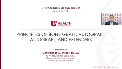Thumbnail for Principles of Bone Graft; Autograft, Allograft, and Extenders