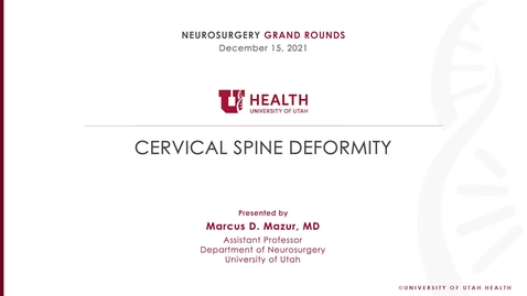 Thumbnail for Cervical Spine Deformity