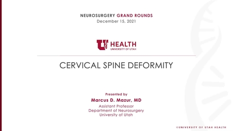 Thumbnail for entry Cervical Spine Deformity