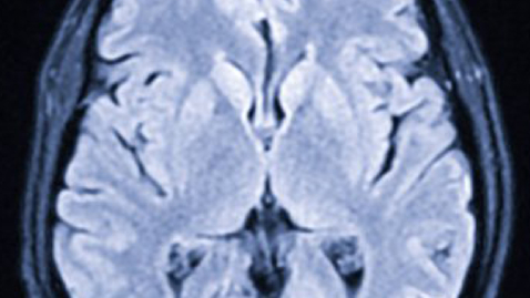 Thumbnail for Patient Story - Zoe’s Traumatic Brain Injury