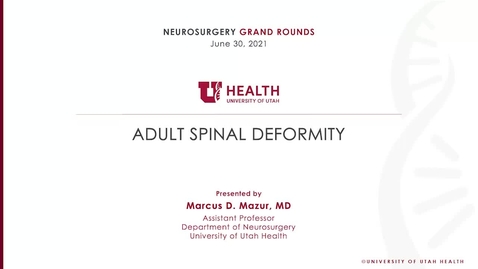 Thumbnail for Adult Spinal Deformity