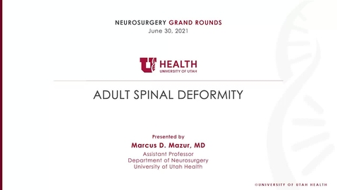 Thumbnail for entry Adult Spinal Deformity
