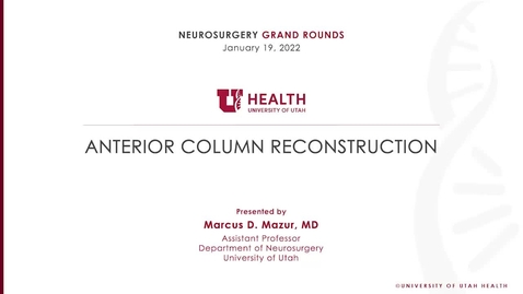 Thumbnail for Anterior Column Reconstruction