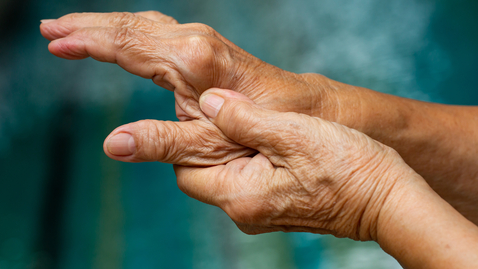 Thumbnail for Managing Thumb Arthritis: Nonsurgical and Surgical Options