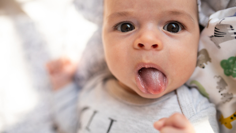 Thumbnail for Does Your Baby Need Tongue-Tie Clipping?