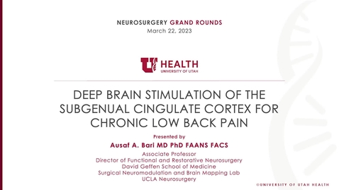 Thumbnail for Deep Brain Stimulation of the  Subgenual Cingulate Cortex for Chronic Low Back Pain