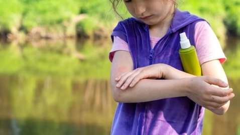 Thumbnail for Effective Strategies to Handle Mosquito Bites in Children