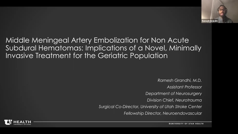 Thumbnail for Middle meningeal artery embolization for non acute subdural hematomas: Implications of a novel, minimally invasive treatment for the geriatric population 