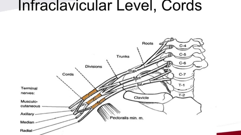 Thumbnail for PC Infraclavicular Axillary