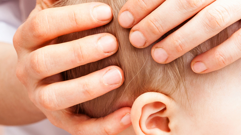 Thumbnail for Surgical Options for Treating Craniosynostosis
