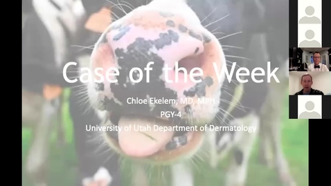 Thumbnail for 12/10/2021 Race, ethnicity, and patch testing-what we know, where are the holes, and where are we going.