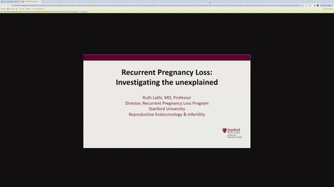 Thumbnail for Recurrent pregnancy loss: Investigating the unexplained