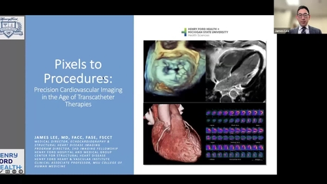 Thumbnail for From Pixels to Procedures: Precision Cardiovascular Imaging in the Age of Transcatheter Therapies - September 9, 2025