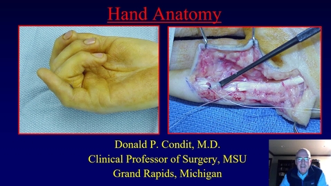 Thumbnail for Hand Anatomy