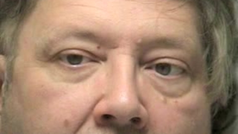 Thumbnail for Extraocular Eye Movements (EOM) Video