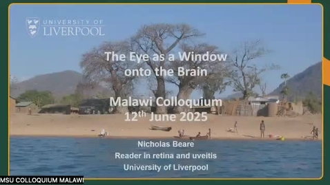 Thumbnail for 3.05 - Dr. Nick Beare - The Eye as a Window onto the Brain