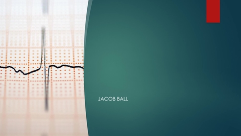 Thumbnail for NEU 311 Honors option part1.Jacob Ball