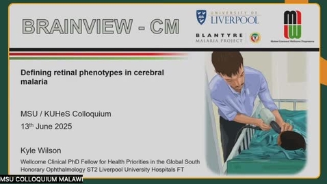 Thumbnail for 3.03 - Dr. Kyle Wilson - Retinal phenotypes in cerebral malaria