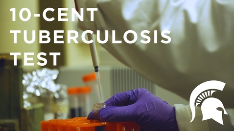 Thumbnail for Alocilja: 10-Cent Tuberculosis Test