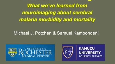 Thumbnail for 4.02 - Dr. Sam Kampondeni, Dr. Michael J. Potchen - A look at the living: What we've learned from neuroimaging about cerebral malaria morbidity and mortality (no audio, slides only)