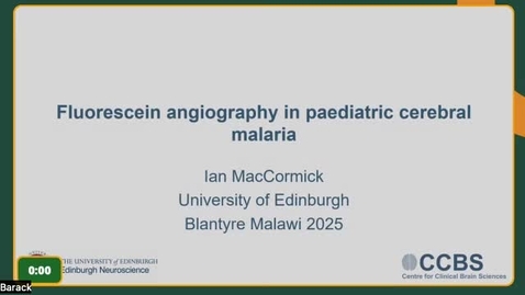Thumbnail for 3.02 - Dr. Ian MacCormick - Fluorescein Angiography in Malaria