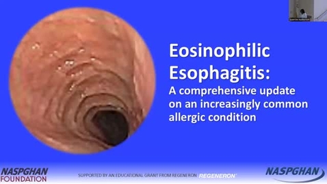Thumbnail for Eosinophilic Esophagitis: A Comprehensive Update on an Increasingly Common Allergic Condition