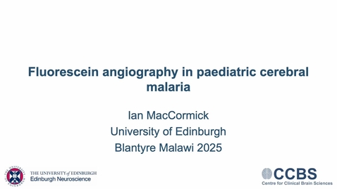 Thumbnail for 3.02 - Dr. Ian MacCormick - Fluorescein Angiography in Malaria (no audio, slides only)