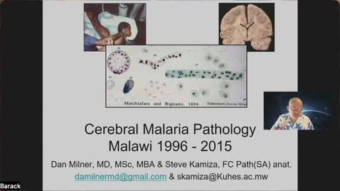 Thumbnail for 2.02 - Dr. Dan Milner and Professor Steve Kamiza - Autopsy, Research and the Pathology of Cerebral Malaria