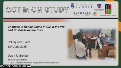 Thumbnail for 3.04 - Mr. Owen Banda - Changes in retinal signs in cerebral malaria in the pre- and post-artesunate eras