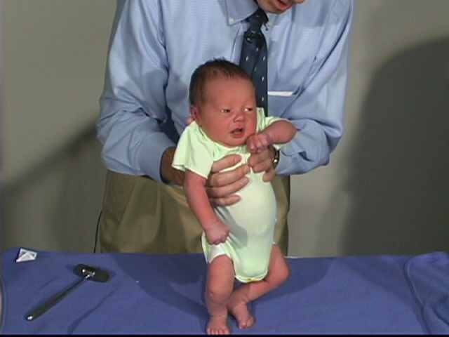 Дистония мышечного тонуса. Мышечный синдром у ребенка. Мышечные дистонические синдромы. Типы нарушения мышечного тонуса. Мышечная гипотония рахит.