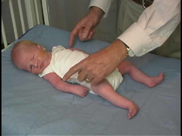 Neurologic Exam-Pediatric | Newborn | Abnormal | Tone - Resting Posture