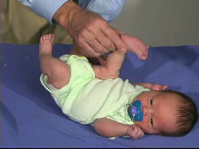 Neurologic Exam-Pediatric | Newborn | Normal | Tone - Heel to Ear