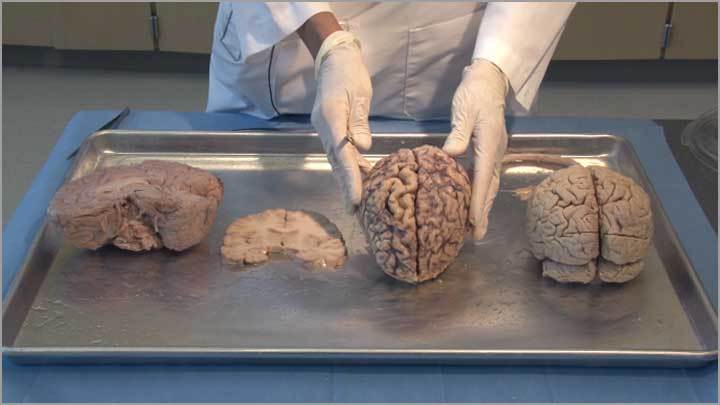 Brain Dissections Neuroanatomy Video Lab