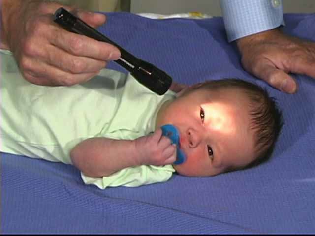 Pediatric Neurologic Examination Videos Descriptions Newborn