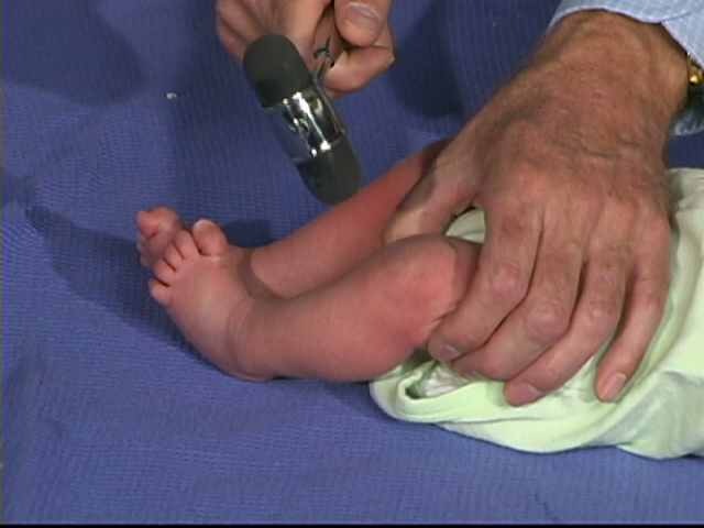 where to check deep tendon reflexes