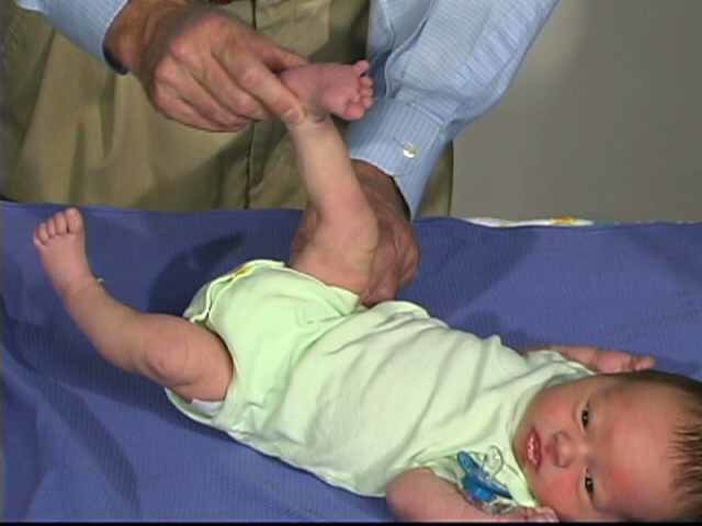 Neurologic Exam-Pediatric | Newborn | Normal | Tone - Leg Traction