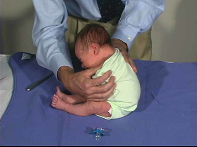 Neurologic Exam-Pediatric | Newborn | Normal | Tone - Head Control
