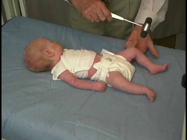 where to check deep tendon reflexes