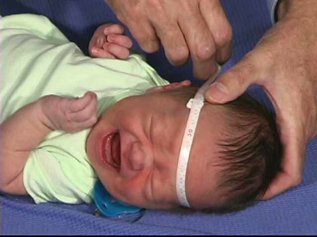 Neurologic Exam-Pediatric | Newborn | Normal | Head Circumference