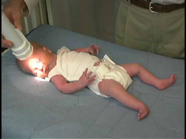 Pediatric Neurologic Examination Videos Descriptions Newborn