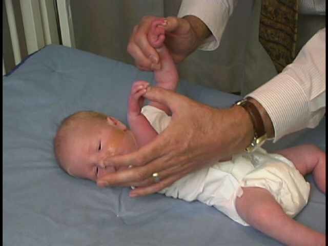 Neurologic Exam-Pediatric | Newborn | Abnormal | Primitive Reflexes